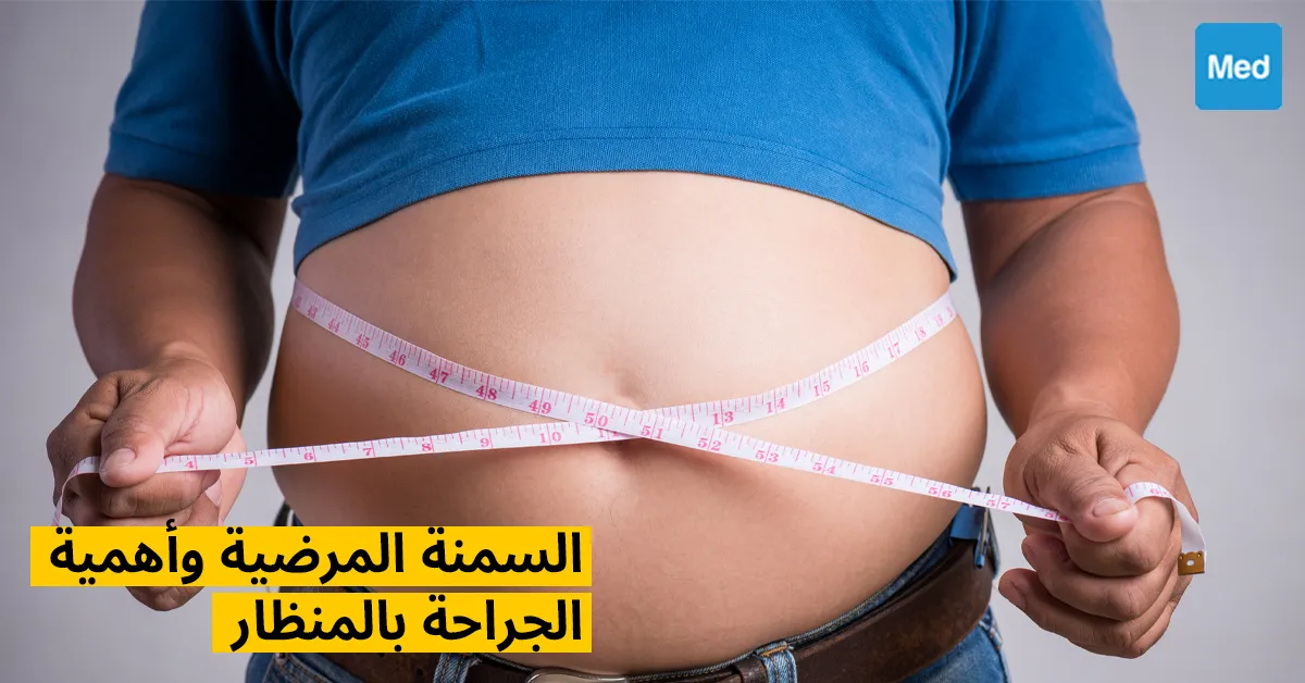 السمنة المرضية وأهمية الجراحة بالمنظار